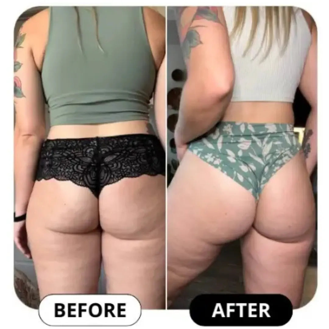 Oveara Anti-Cellulite Cream