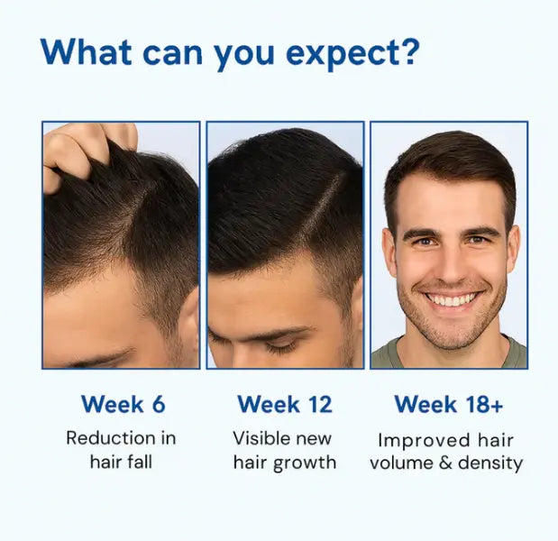 Oveara Hair Growth Serum