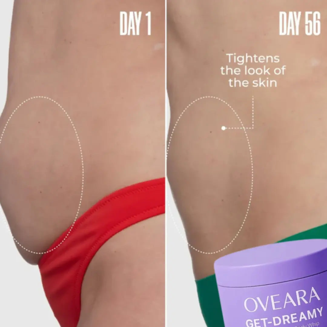 Oveara™ Firming Anti-Cellulite Cream